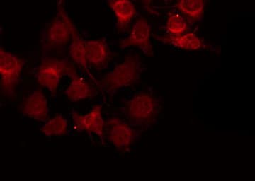 Polyclonal Rabbit anti-Human ZFP36L1 Antibody (IF, WB)