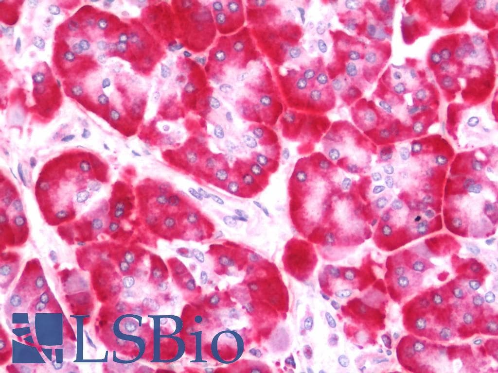 IHC-plus™ Polyclonal Rabbit anti-Human NOSTRIN Antibody (IHC, IF, WB)