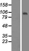 TUT1 Protein (Over-Expression Lysate Myc-DDK (Flag))