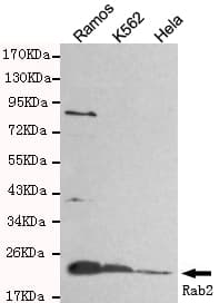 IHC-plus™ RAB2A / RAB2 Antibody