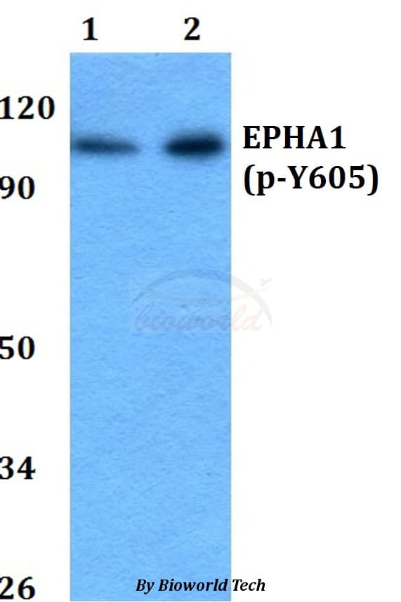 EPHA1 / EPH Receptor A1 Antibody (phospho-Tyr605)