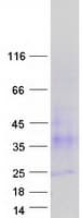 Human TSPAN3 Protein (Recombinant Myc-DDK (Flag))
