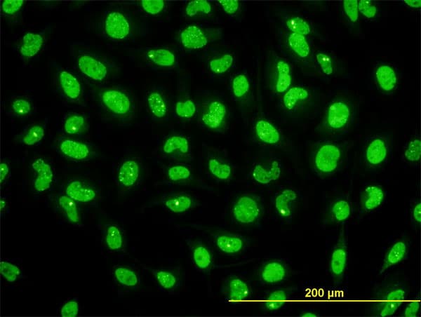 Monoclonal Mouse anti-Human STK38 Antibody (clone 2G8-1F3, IHC, IF, WB)