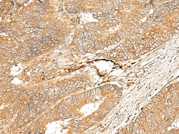 ADGRF5 / GPR116 Antibody