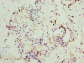CSNK1G1 / CKI-Gamma 1 Antibody