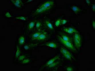 SIPA1 Antibody