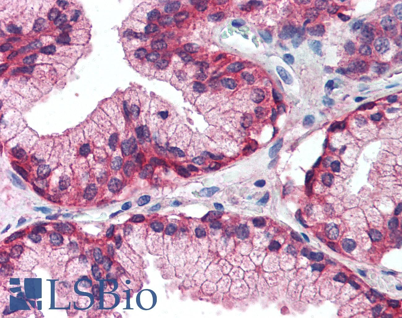 IHC-plus™ EGFR Antibody (Internal)