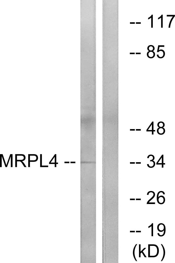 IHC-plus™ MRPL4 / MRP-L4 Antibody (aa90-139)