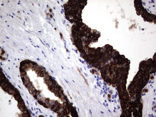 KRT19 / CK19 / Cytokeratin 19 Antibody (aa240-390, clone OTI1C11)
