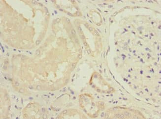 Polyclonal Rabbit anti-Human NDUFV1 Antibody (IHC, WB)