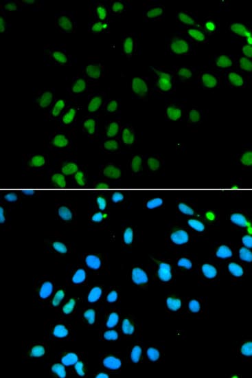 Polyclonal Rabbit anti-Human MNAT1 Antibody (IHC, IF, WB)