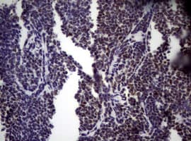 NBN / Nibrin Antibody (clone OTI6E11)