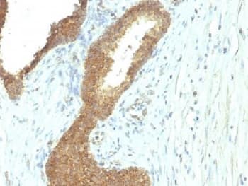 Alkaline Phosphatase Antibody (clone ALPL/597)