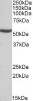 IHC-plus™ ALDH6A1 Antibody (aa262-272)