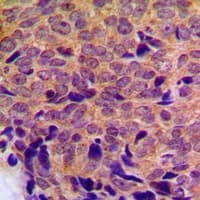 CYP21A2 Antibody (Internal)