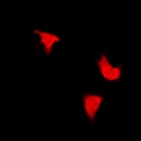 IRS1 Antibody (phospho-Ser312)