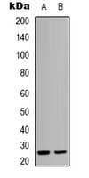 HMG2 / HMGB2 Antibody (Internal)