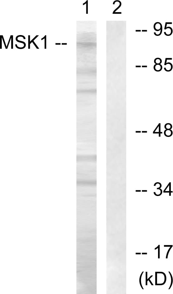 IHC-plus™ Polyclonal Rabbit anti-Human RPS6KA5 / MSK1 Antibody (aa331-380, IHC, WB)