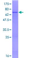Human CHIA / Amcase Protein (Recombinant GST)