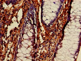 Polyclonal Rabbit anti-Human BECN1 / Beclin-1 Antibody (IHC, IF, WB)
