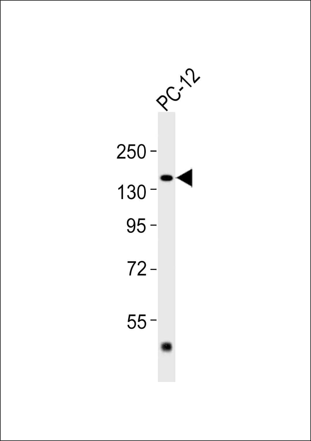 IHC-plus™ ADCY5 / Adenylate Cyclase 5 Antibody
