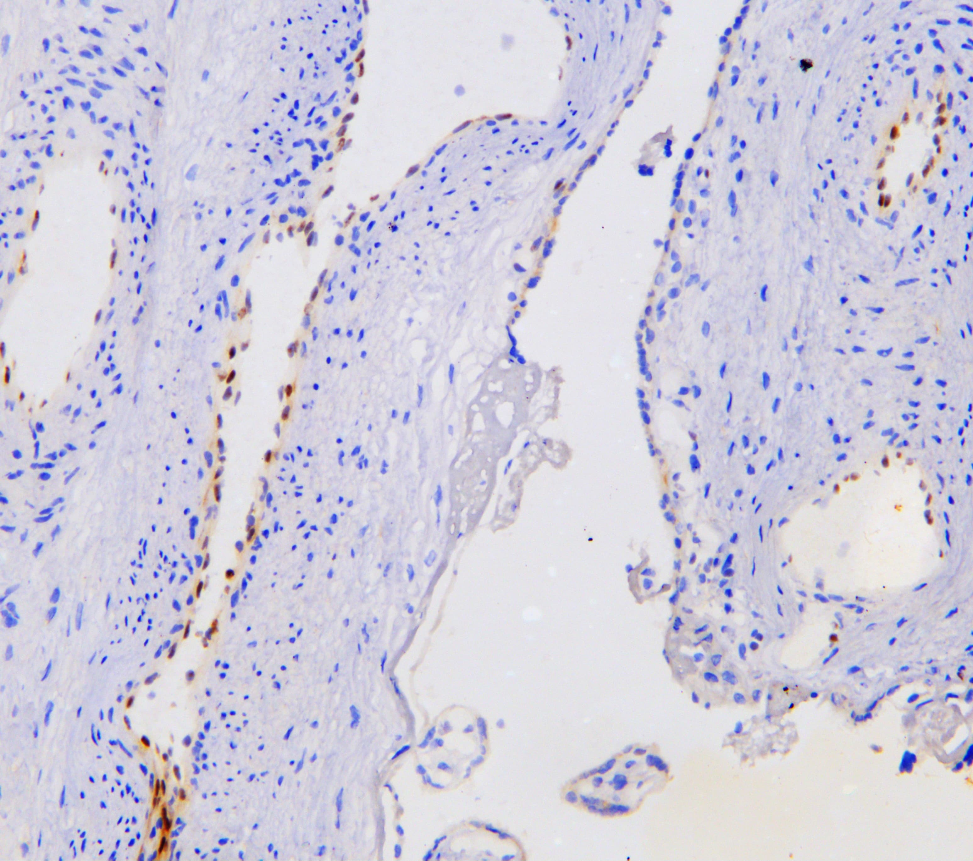 NOVA1 Antibody