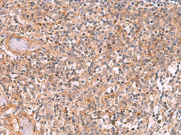 Polyclonal Rabbit anti-Human CREBBP / CREB Binding Protein Antibody (IHC)