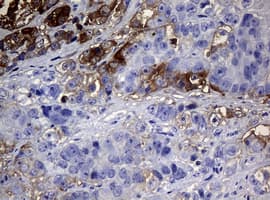 NME1 / NM23 Antibody (clone OTI6A11)