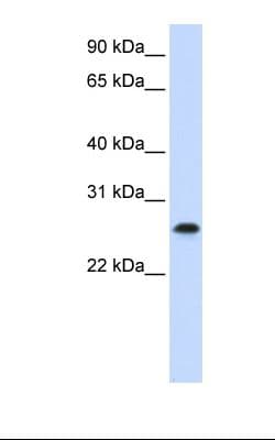 Polyclonal Rabbit anti-Human PHF19 Antibody (FITC, C-Terminus, WB)