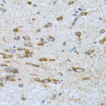 PDP1 Antibody