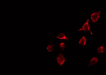 TNFRSF1B / TNFR2 Antibody