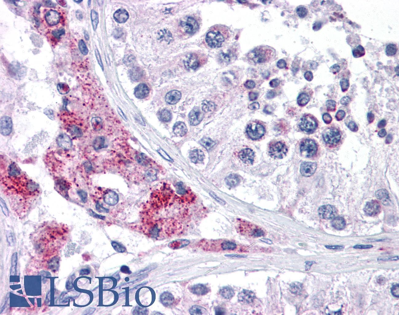 IHC-plus™ PTCHD2 Antibody