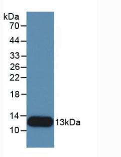 IL8 / Interleukin 8 Antibody
