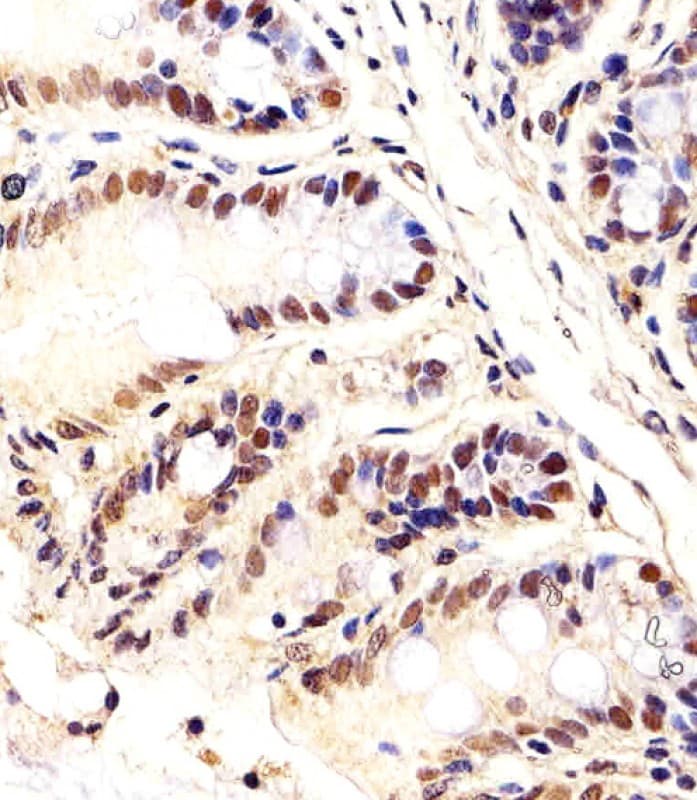 Polyclonal Rabbit anti-Mouse CTR9 Antibody (aa1022-1056, IHC, IF, WB)