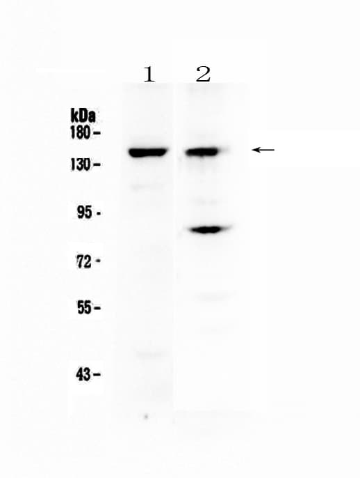 Polyclonal Rabbit anti-Human JHDM1A / KDM2A Antibody (WB)