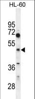 CEPT1 Antibody (aa29-57)
