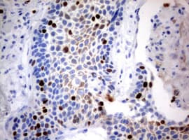 Monoclonal Mouse anti-Human MKI67 / Ki67 Antibody (clone OTI5E4, aa1160-1493, IHC)