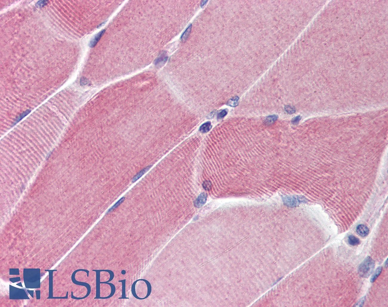 IHC-plus™ PTPN11 / SHP-2 / NS1 Antibody