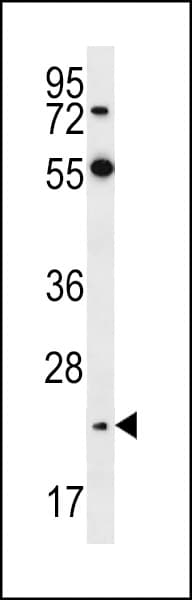 NEUROG2 / NGN2 / Neurogenin 2 Antibody (aa242-272)