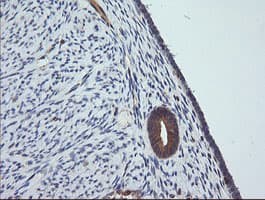 MAP2K1 / MKK1 / MEK1 Antibody (clone OTI4E1)