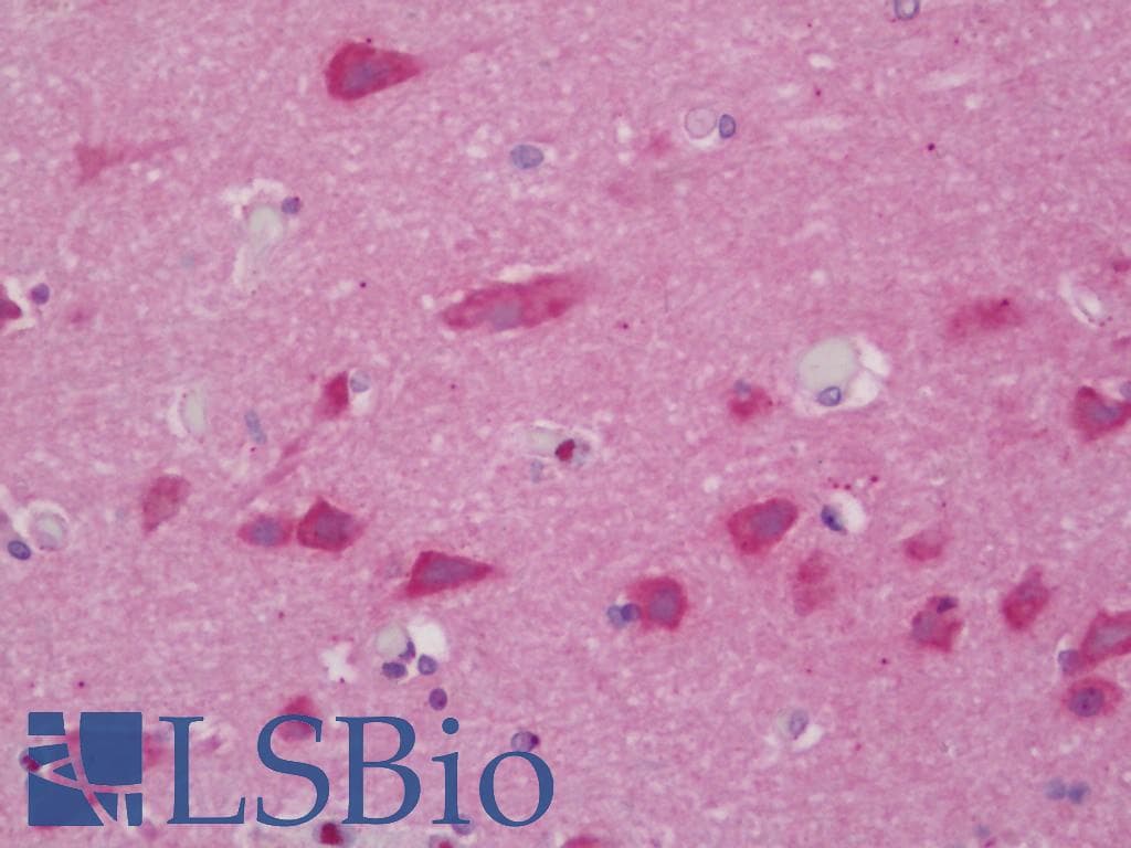 IHC-plus™ Polyclonal Rabbit anti-Human NRP1 / Neuropilin 1 Antibody (aa476-525, IHC, WB)