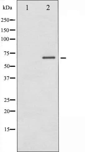 Polyclonal Rabbit anti-Human PAK1 Antibody (phospho-Thr212, IHC, IF, WB)