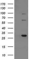 Monoclonal Mouse anti-Human TRIM38 Antibody (clone OTI16D9, IHC, WB)