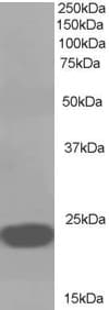 IHC-plus™ PEBP1 / RKIP Antibody (aa175-187)