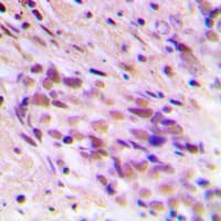 CDYL2 Antibody (N-Terminus)