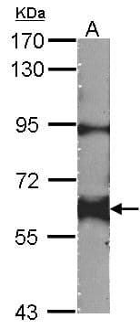 IHC-plus™ YES1 / c-Yes Antibody