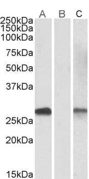 IHC-plus™ Polyclonal Goat anti-Human DYDC1 Antibody (aa142-154, IHC, WB)
