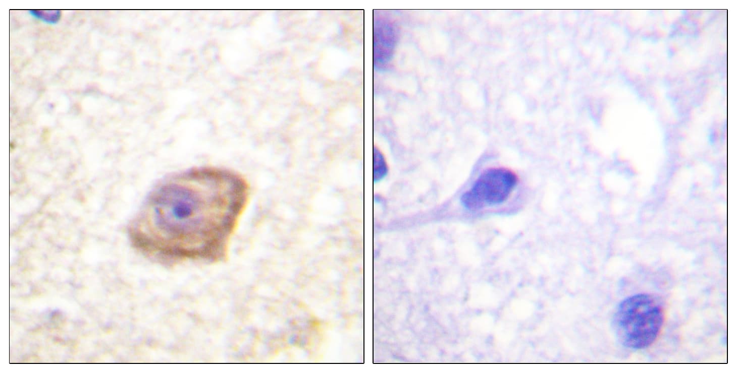 GRIN2B / NMDAR2B / NR2B Antibody (phospho-Tyr1474)