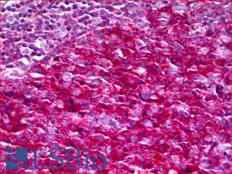 IHC-plus™ Neurofibromin / NF1 Antibody (aa1551-1600)