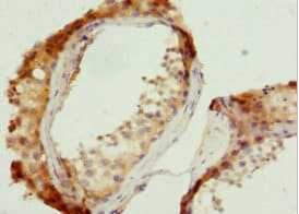 VPS35 Antibody